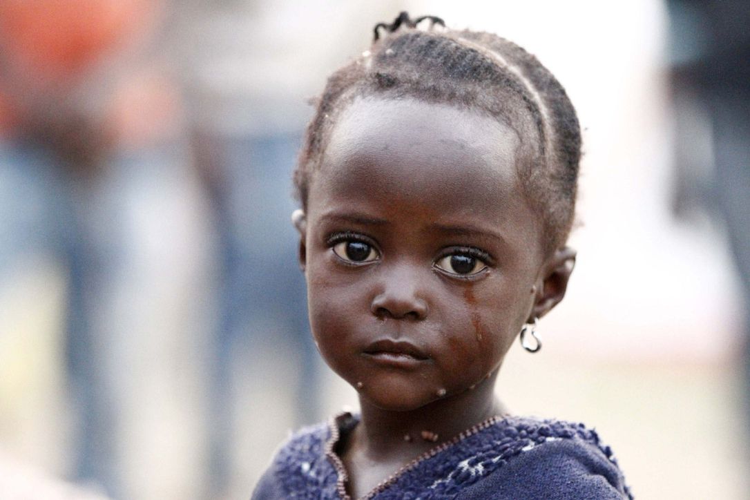 Help Fanta with her medical bill
